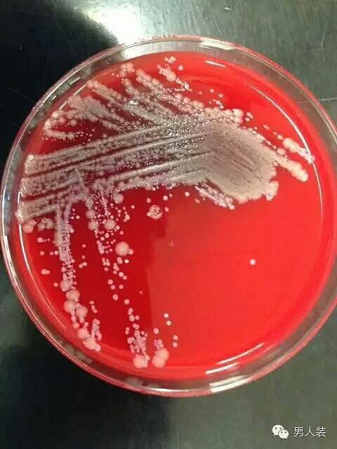 有个问题 : 姑娘们的<em>乳罩有多脏</em> ?-时尚资讯-咖