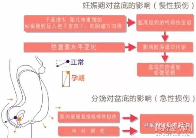 杭州产后盆底修复-Shopping帮-杭州19楼