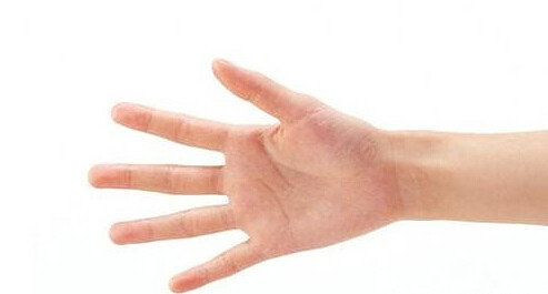 孕妇手肿怎么办?吃什么比较好?