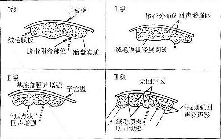 什么是胎盘成熟度?第几级标志成熟?-宝妈知识