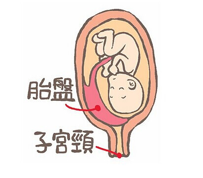 ̥P焃Ε(hu)̥P焃