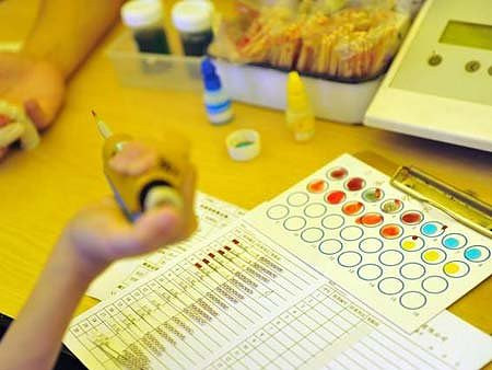 梅毒血清试验数据解读,如何看化验单?-宝妈知