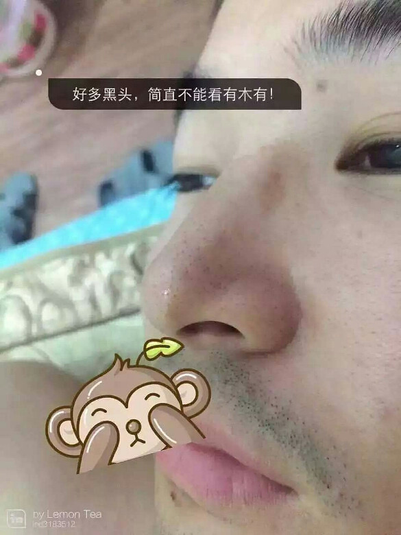 【去黑头小技巧】v技巧保鲜膜一张,语言Tstc函数面膜详解调用图片