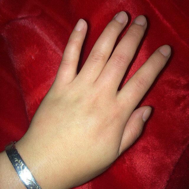 冬天总手脚冰凉没在意 最后发现手指都冻成紫