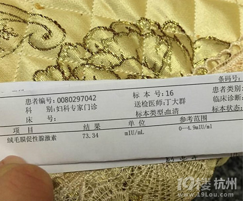 17號(hào)排卵，官方啦��！數(shù)值很好，卵泡小第一次測(cè)到成熟卵泡成功啦
