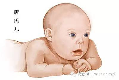 二胎妈妈一定要做唐氏筛查