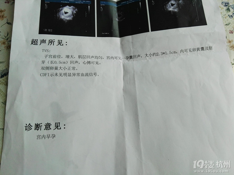 第一次7w+3的B超猜男女,孕期娱乐