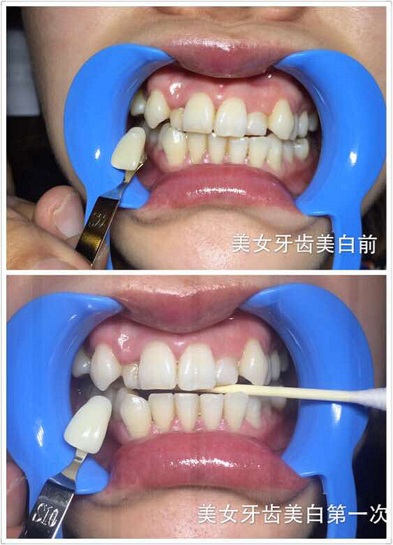 �����������ף�������Ʒ��ֲ����ȡ��������