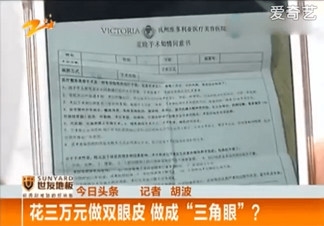 杭州维多拉亚整形医院双眼皮失败,结果成三角眼满脸凶相