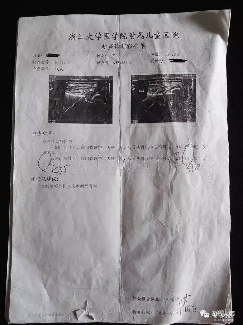 我的孩子會是畸形嗎？跑了2年多醫(yī)院終于有了新說