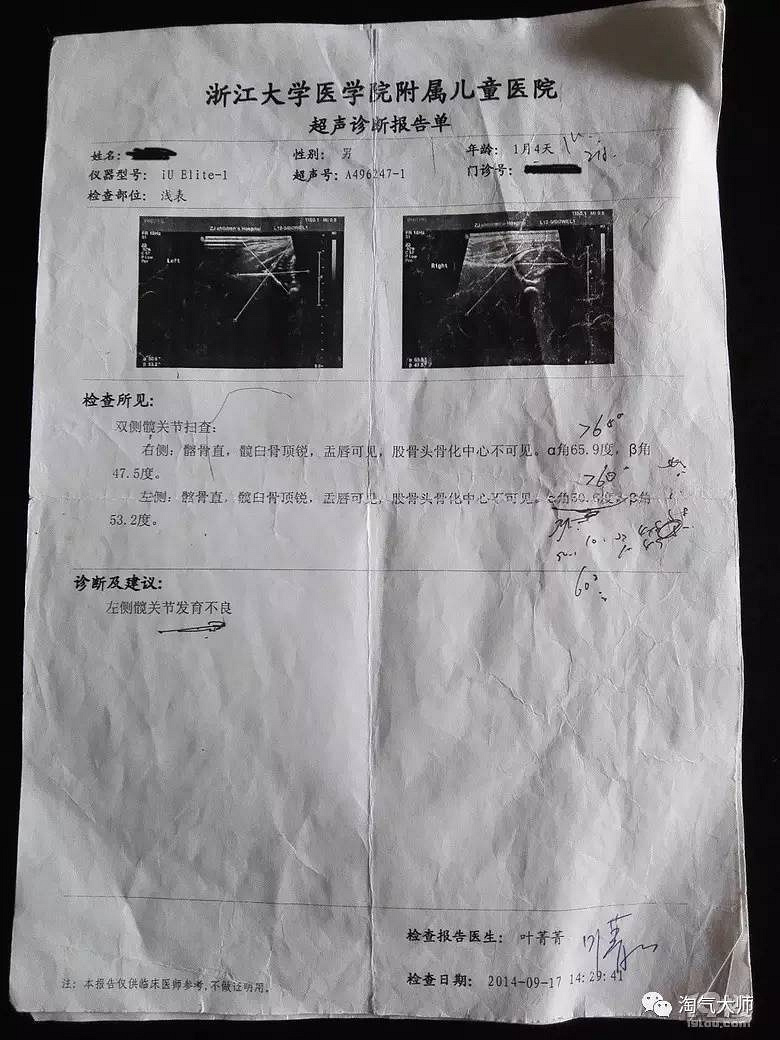 我的孩子會是畸形嗎？跑了2年多醫(yī)院終于有了新說