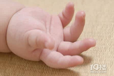 婴儿手肿了怎么回事 婴儿手肿是什么原因