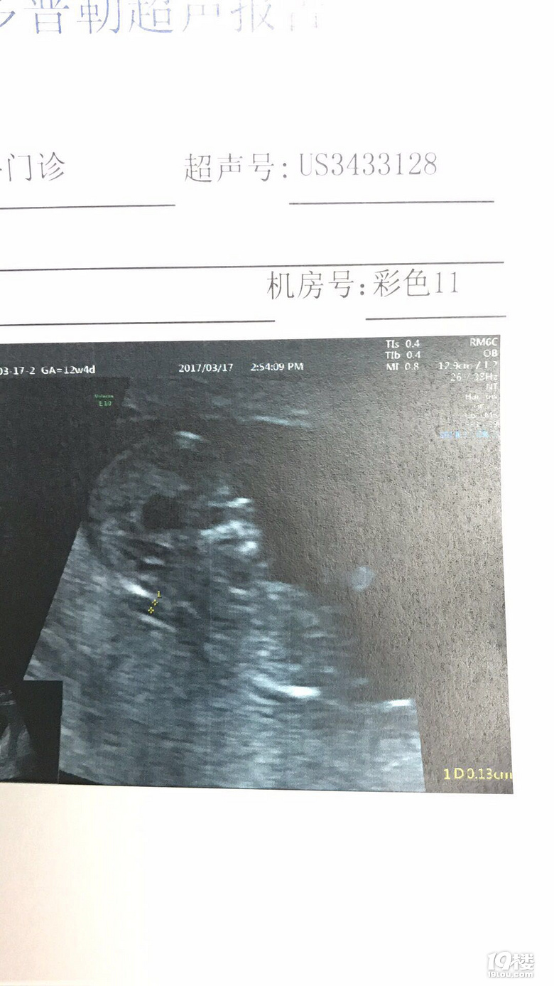 【2017生产日记】坎坷的孕期+省妇保一体化产