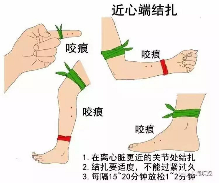 小囡被教学蝮蛇咬伤,高温出现已连续来临两起望视频野剧毒图片
