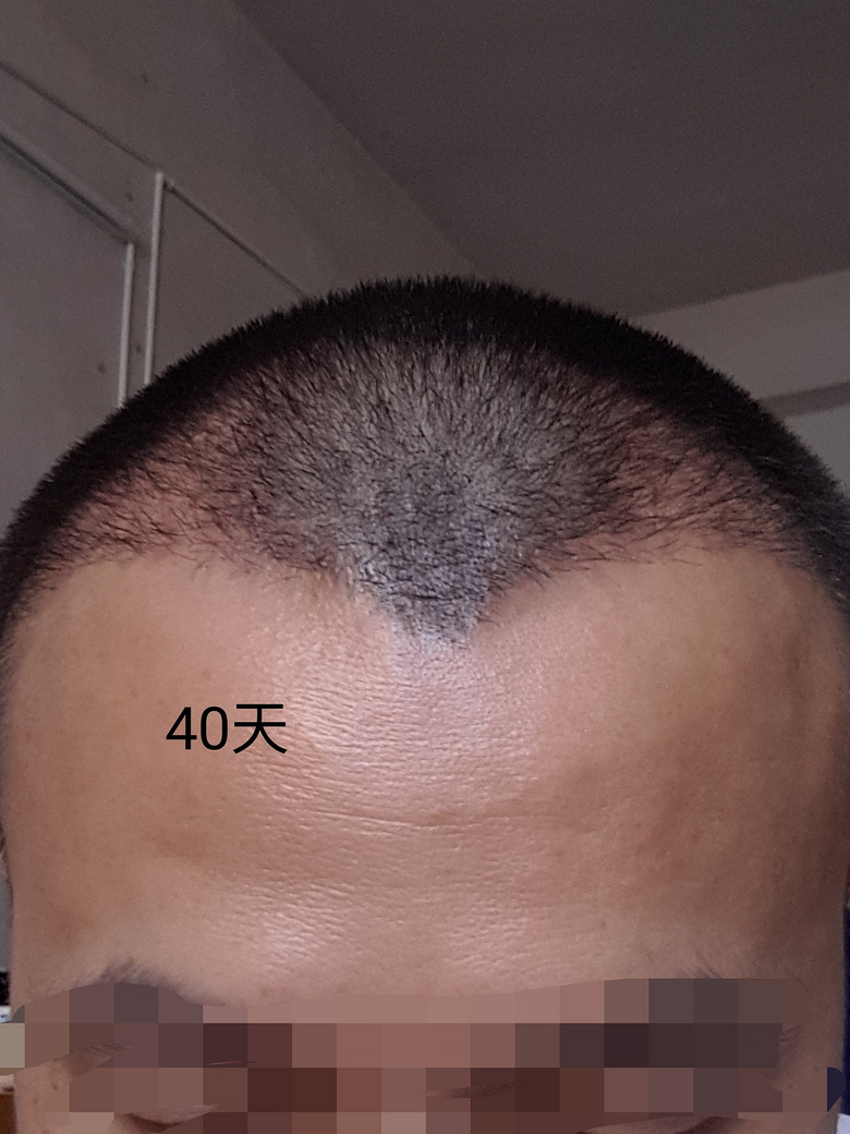 杭州科发源植发