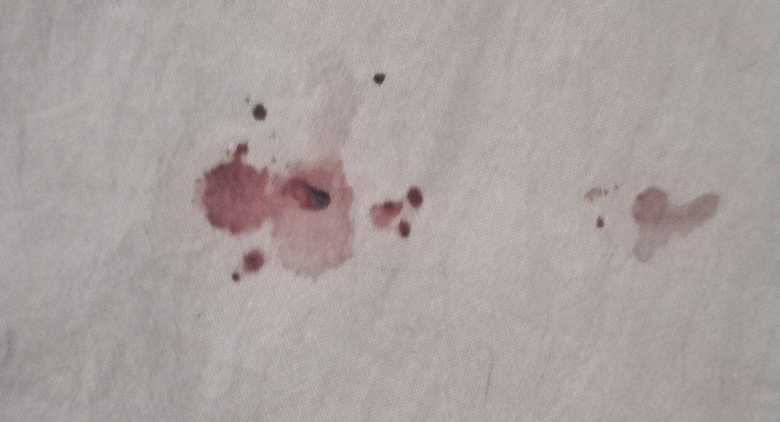 o؈ȫڰ(du)һNÓ