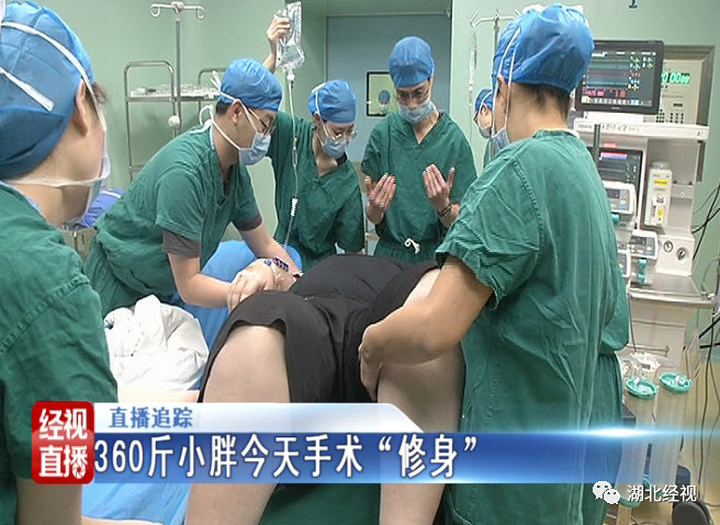 湖北360斤小伙减肥减肥,切胃手术愁坏医生…三做仰卧起坐未遂个多少图片