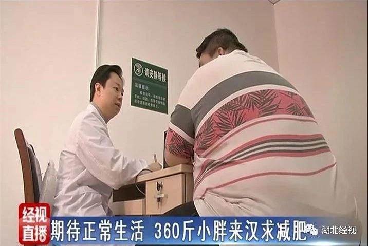 湖北360斤小伙减肥未遂,切胃手术愁坏医生…三跑步减脂多少的速度图片