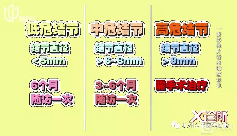 一张影像片读出肺癌危机!杭州全景李成州院长受邀做客《X诊所》!