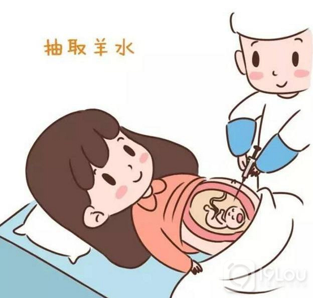 高齡產(chǎn)婦的必要檢查與注意事項！