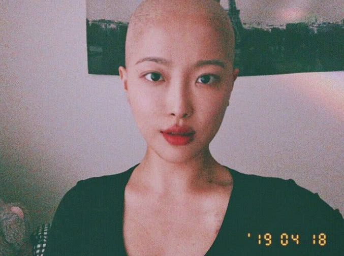 韩国网红患癌后录剃光头视频,又哭又笑强装坚