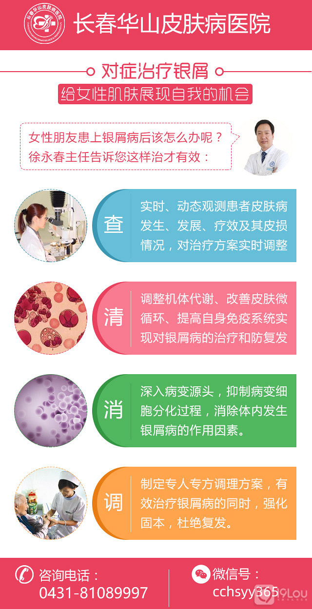 长春牛皮癣怎样治疗好