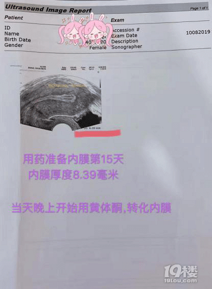 ϹƬʸ_30%ͨ^MACSY鼼g(sh)AŮpȫ