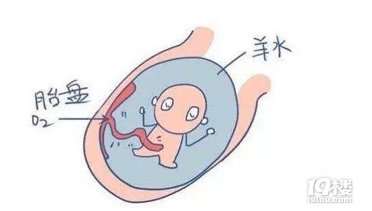 孕晚期羊水偏少被迫早產(chǎn)，羊水少該怎么辦？