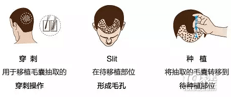 ʲôNOCUTl(f)ֲl(f)g(sh) ֲl(f)t(y)ν