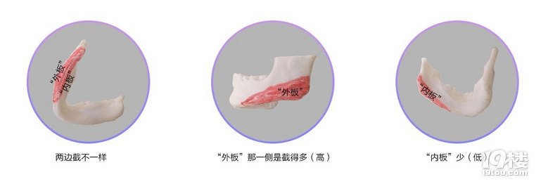 (ni)壿Mg(sh)Ūʲô