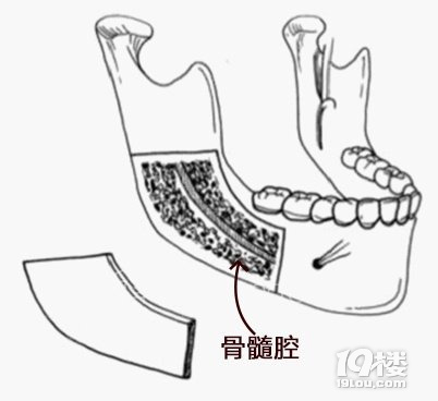 (ni)壿Mg(sh)Ūʲô