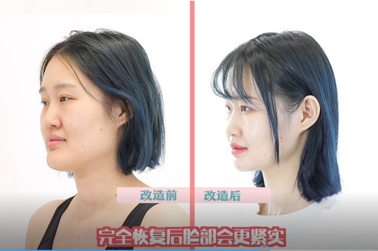 长腿妹因鞋拔子脸被认成男生?花40万动骨大哥变成软甜萌妹!
