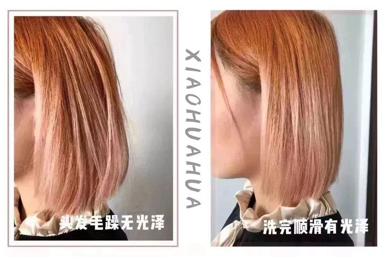 家里蹲的第10天，我的頭發(fā)里竟然長了這種東西！