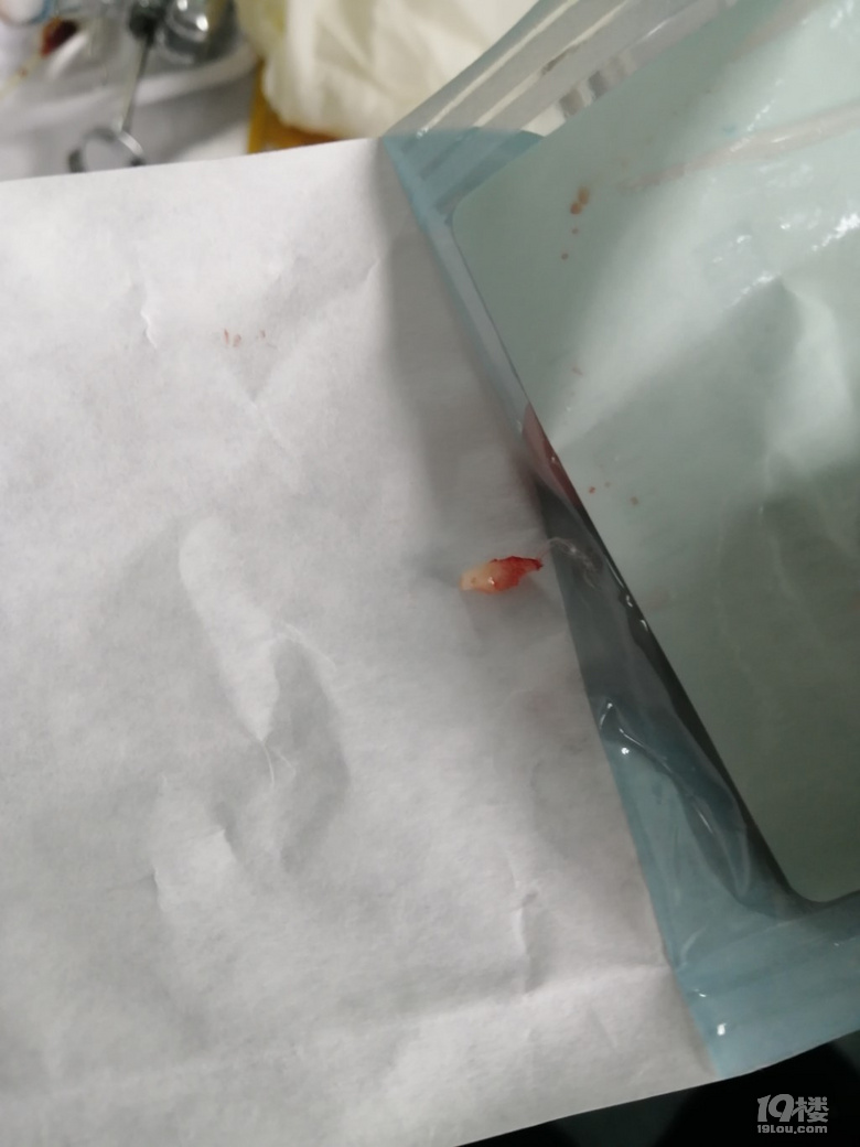 致第一顆逝去的乳牙