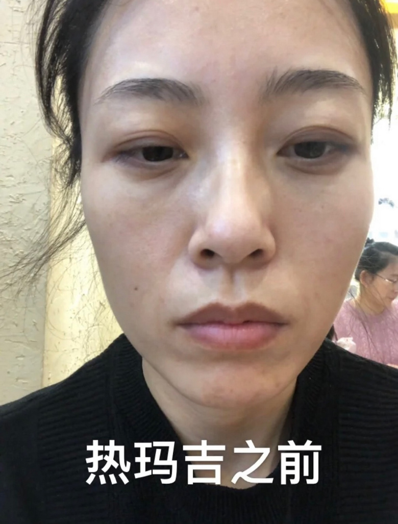 ʮğᬔF(xin)20Kڿ(li)c(din)Ч