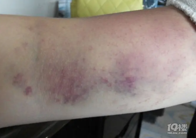 Ĥʲô˲L(fng)U(xin)