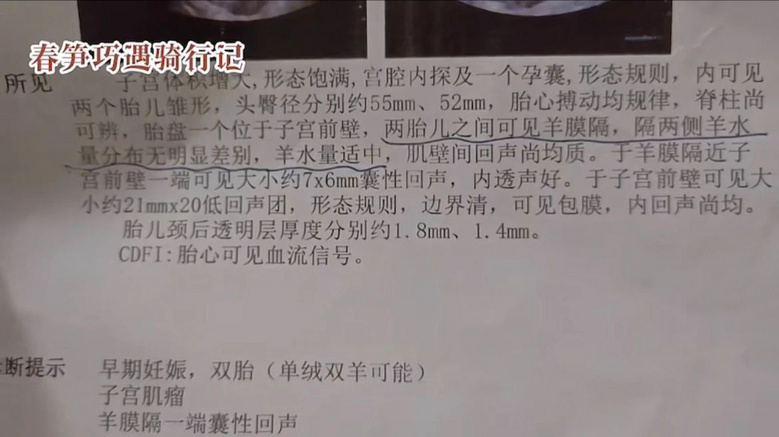 流浪狗跟小夫妻跑了200多公里，以為它想要個家，結果卻為了保