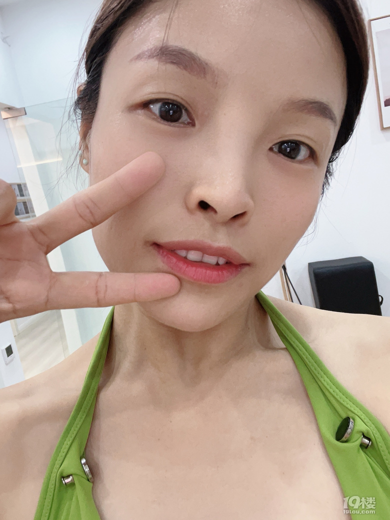 濕疹快好了 耶～ 希望不要再反復(fù)