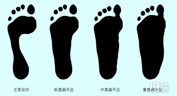 ЩⷭǱƽ᣿(li)Ԝy(c)һ