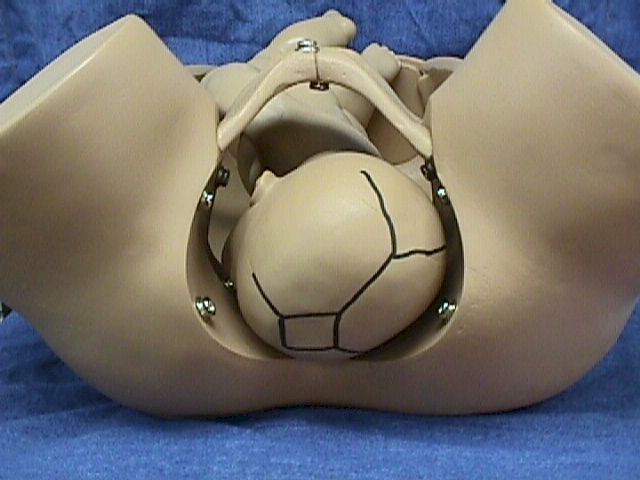 胎位ROA是什么意思啊?-准妈妈论坛-杭州19楼