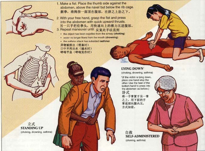 孩子噎着了怎么办?海姆利希急救法-孩爸孩妈聊