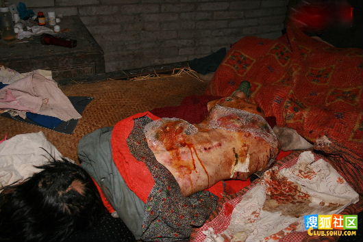 转帖:一个创造生命奇迹的母亲(太震撼了!!)