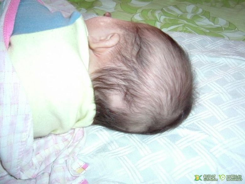 求助2个月的<em>宝宝</em>为什么会掉<em>头发</em>,而且<em>一块一块</em>