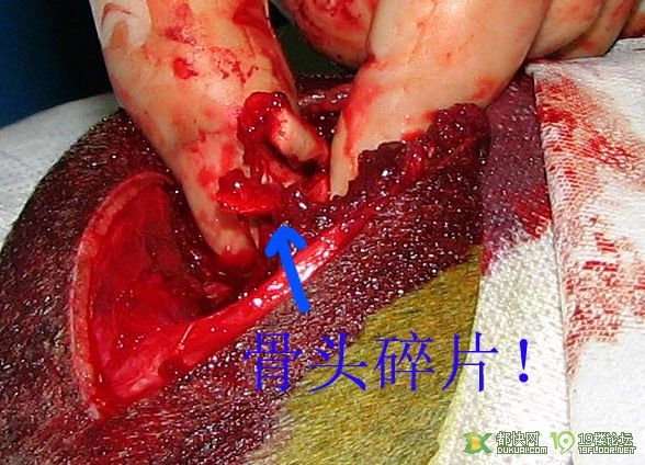 洋洋骨折手术日记!更新到7月22日,附手术全程清晰图(有些血腥,请害怕的人慎入)-家有宠物-杭州19楼