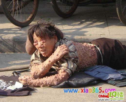一个女乞丐-草根消息-杭州19楼