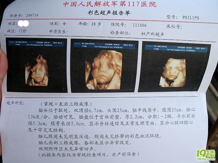 欢迎来交流:27周+3天,晒晒我的三维宝宝-准妈
