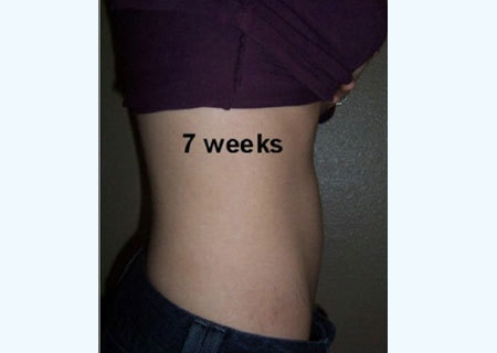 三胞胎母亲怀孕全过程(转帖)-准妈妈论坛-杭州