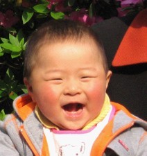 询问:这两天儿子后脑芍出汗厉害