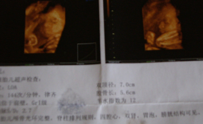 孕28周做三维B超-准妈妈论坛-杭州19楼