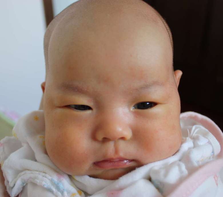 难免流产、艰辛保胎,我的宝宝来之不易-准妈妈